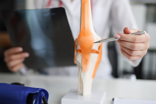 Todo Sobre La Prótesis De Rodilla